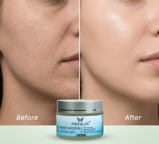 Perius Moisturizer Lotion
