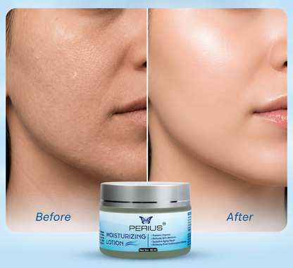 Perius Moisturizer Lotion