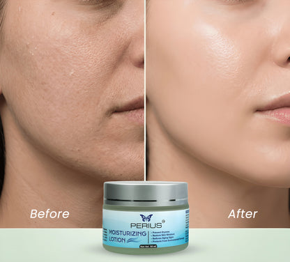 Perius Moisturizer Lotion