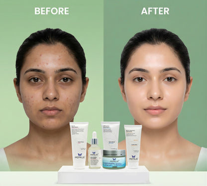 Before and after comparison of a woman's face with perius  skincare products displayed