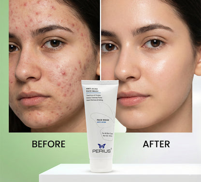 Perius Anti Acne Face Wash